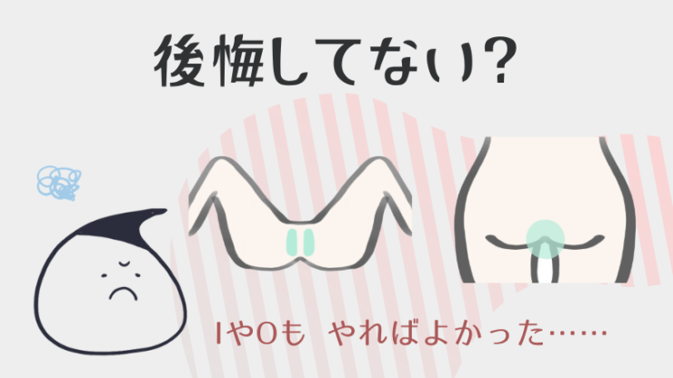 やっぱりIOも脱毛すればよかったと後悔してない?