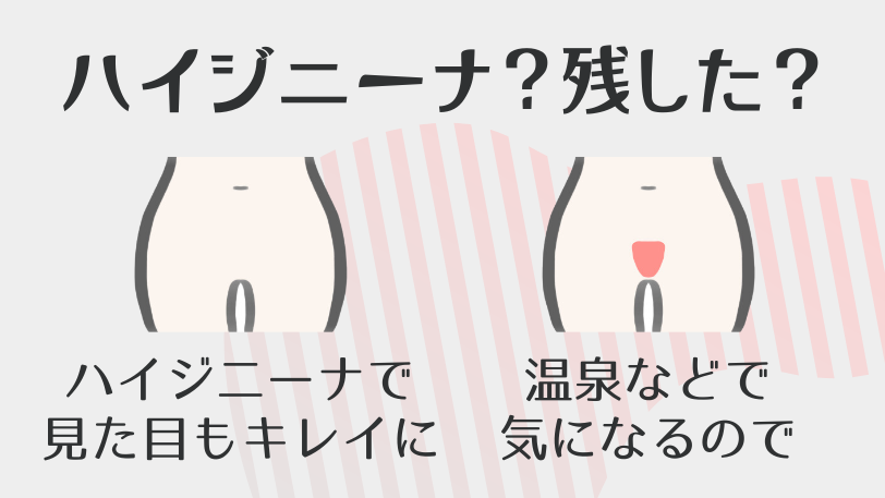 Vラインはハイジニーナ?残した?